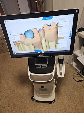 Fotografie reală din clinica Denti Service Bacău — monitor cu model 3D dentar utilizat în planificarea digitală a lucrării fixe pe implanturi