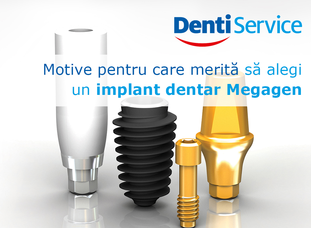 Implant dentar Megagen – De ce să-l alegi?
