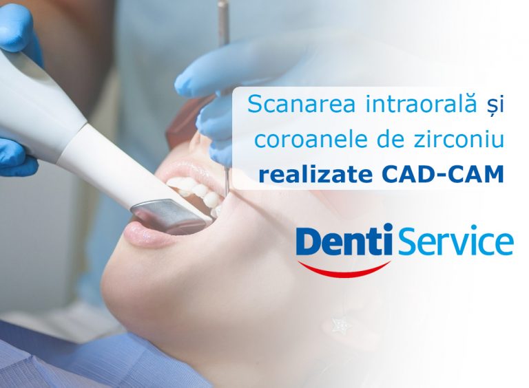Scanarea intraorală și coroanele de zirconiu realizate CAD-CAM